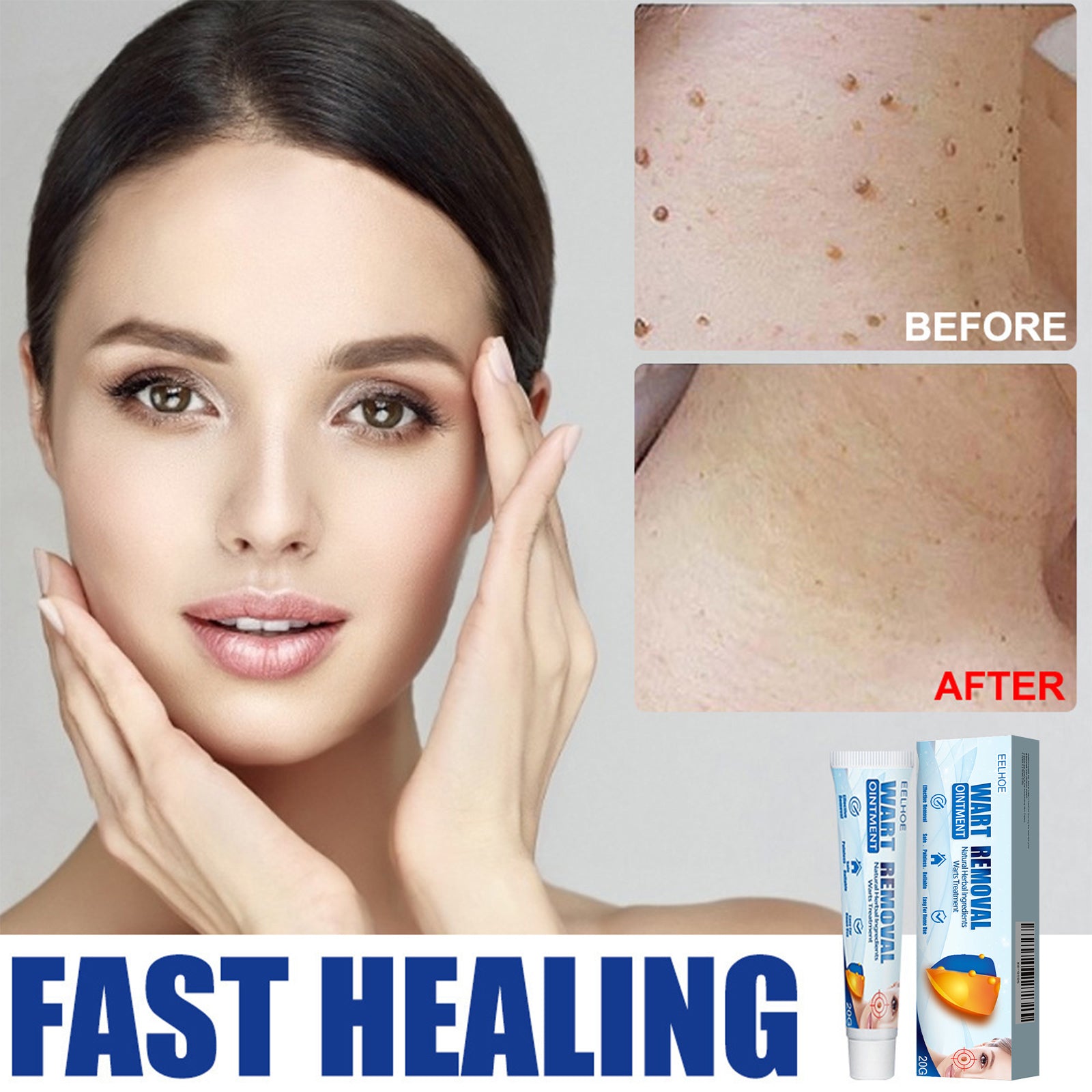 EELHOE Keyu Cream, Clean Skin Repair Care Body Face Remove Face Label Keyu