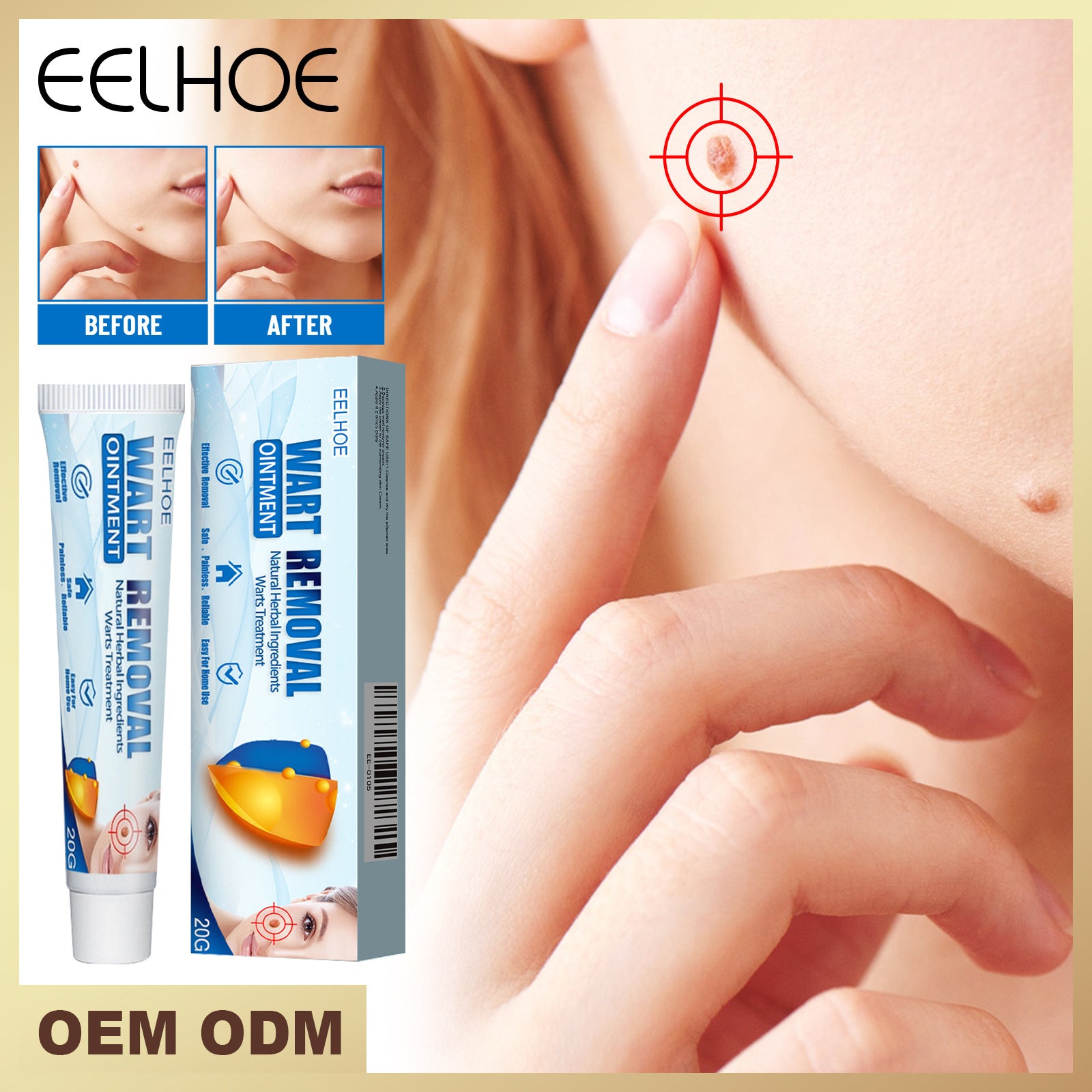 EELHOE Keyu Cream, Clean Skin Repair Care Body Face Remove Face Label Keyu