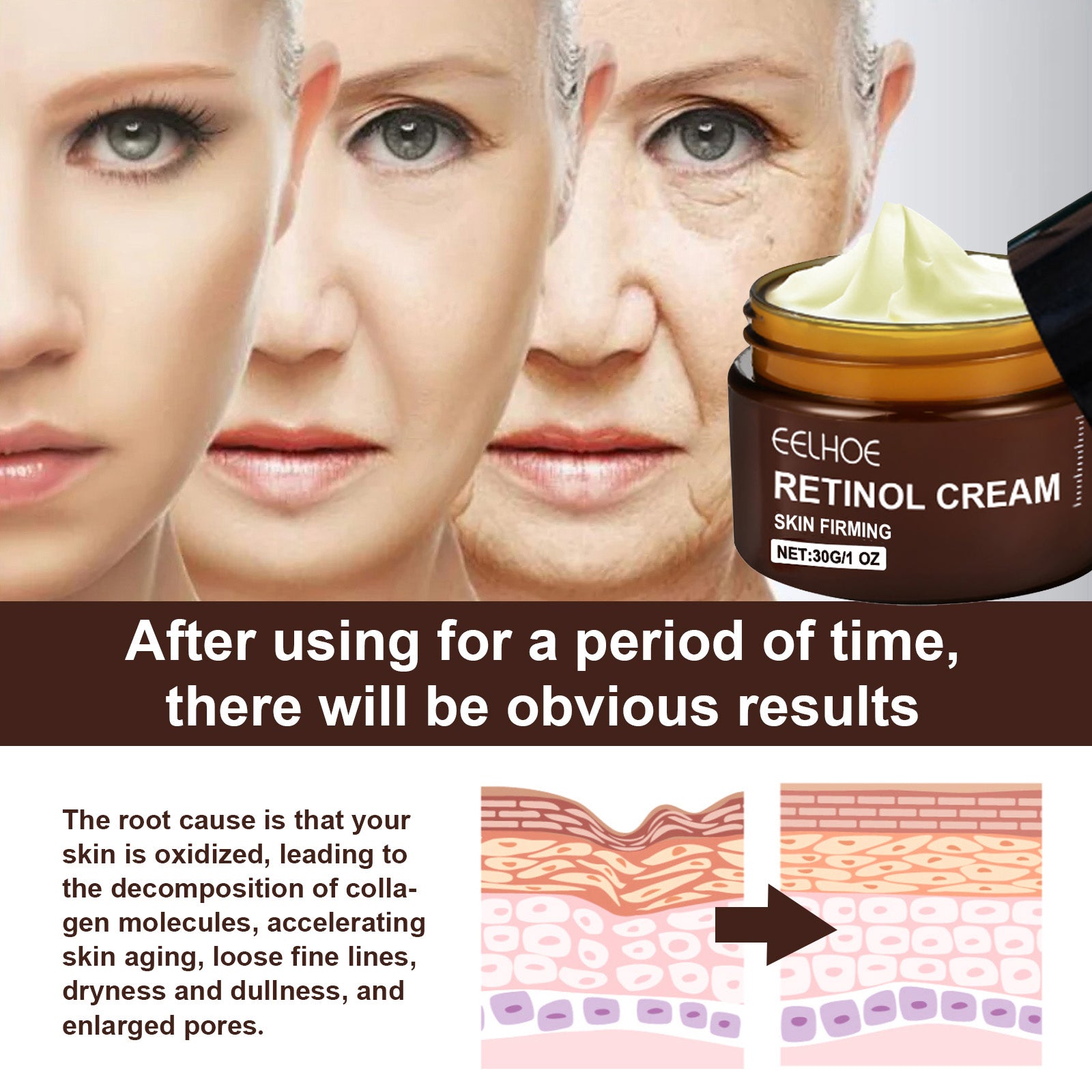 EELHOE Retinol Cream