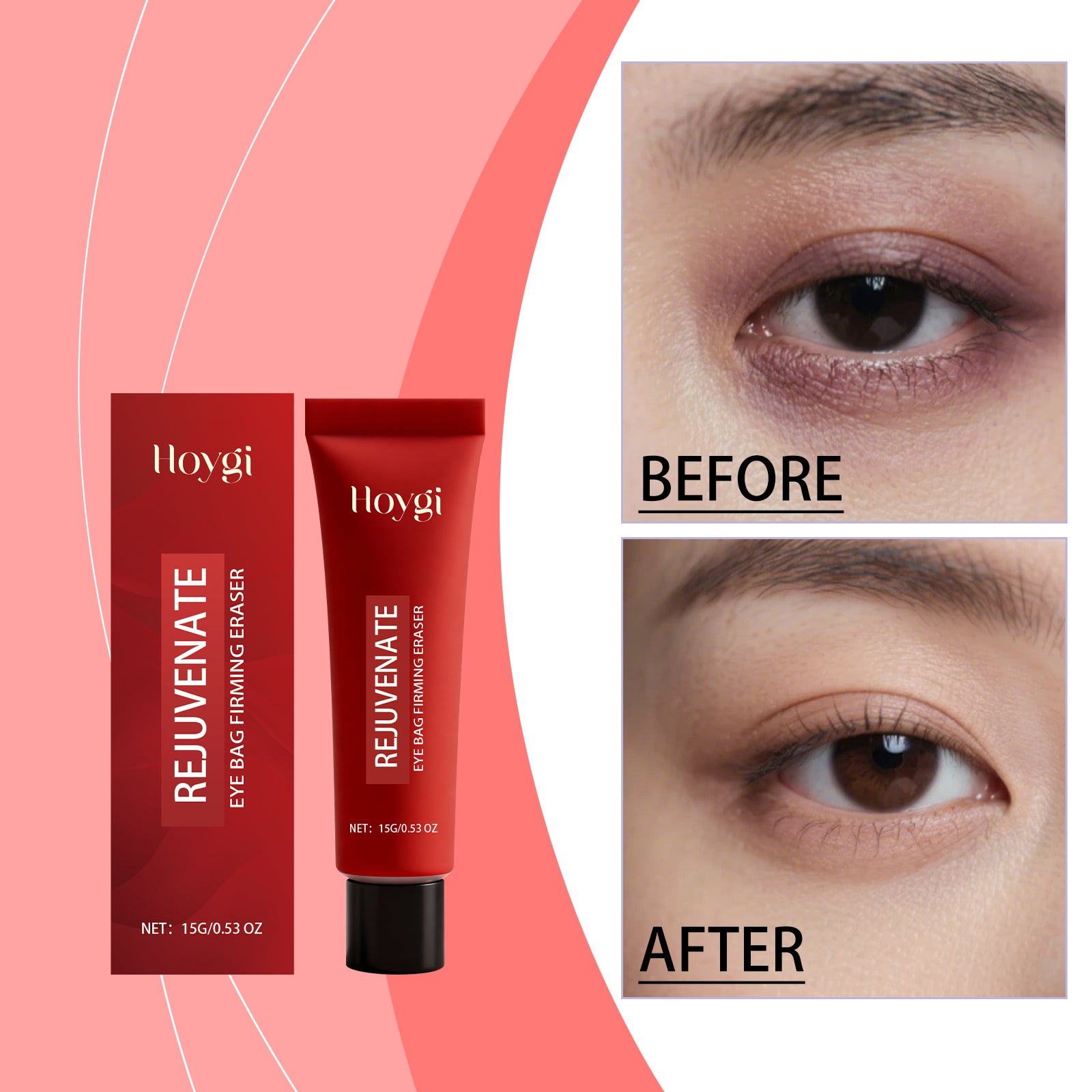Hoygi Eye Moisturizing Gel Gently Nourishes The Skin Around The Eyes And
