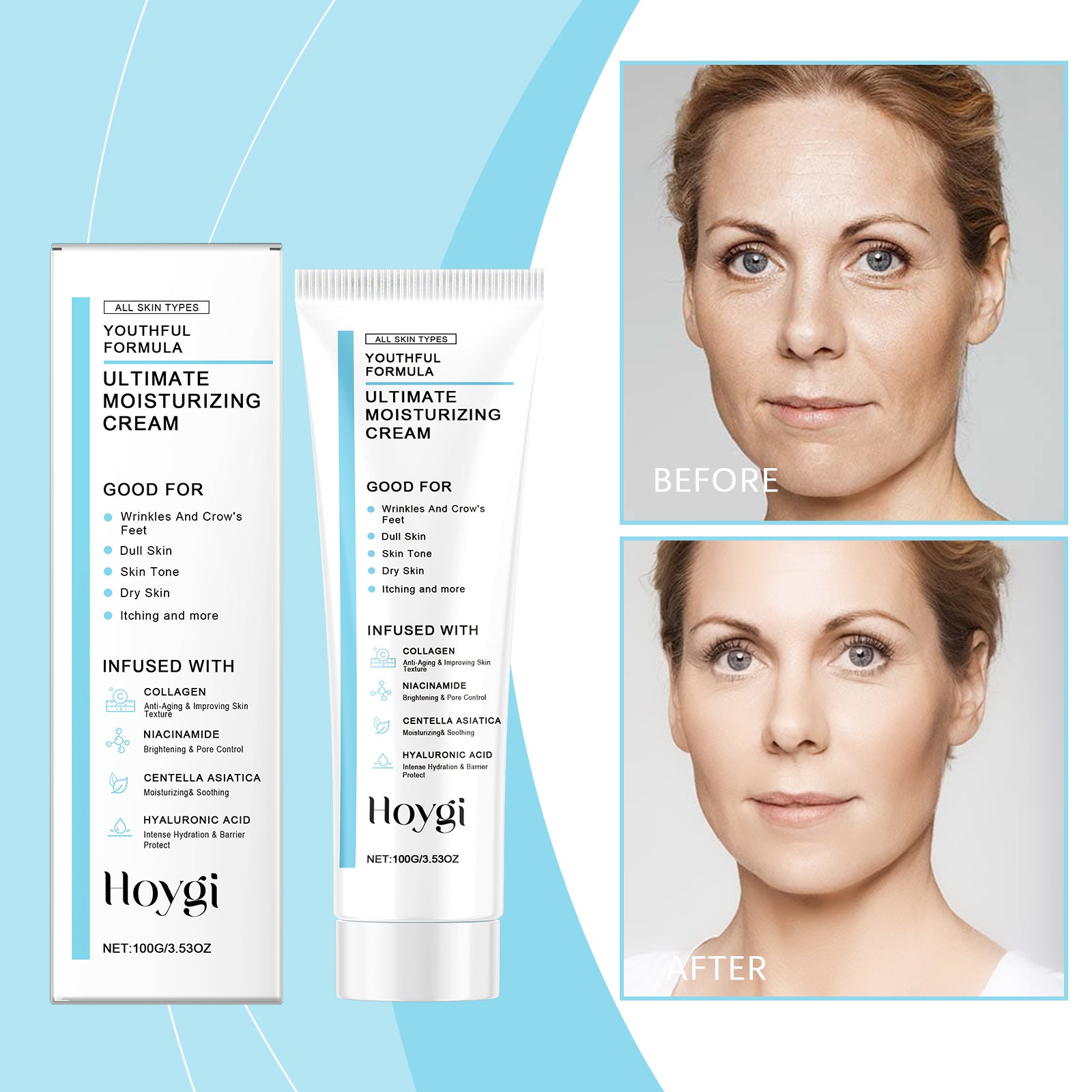Hoygi Centella Moisturizer