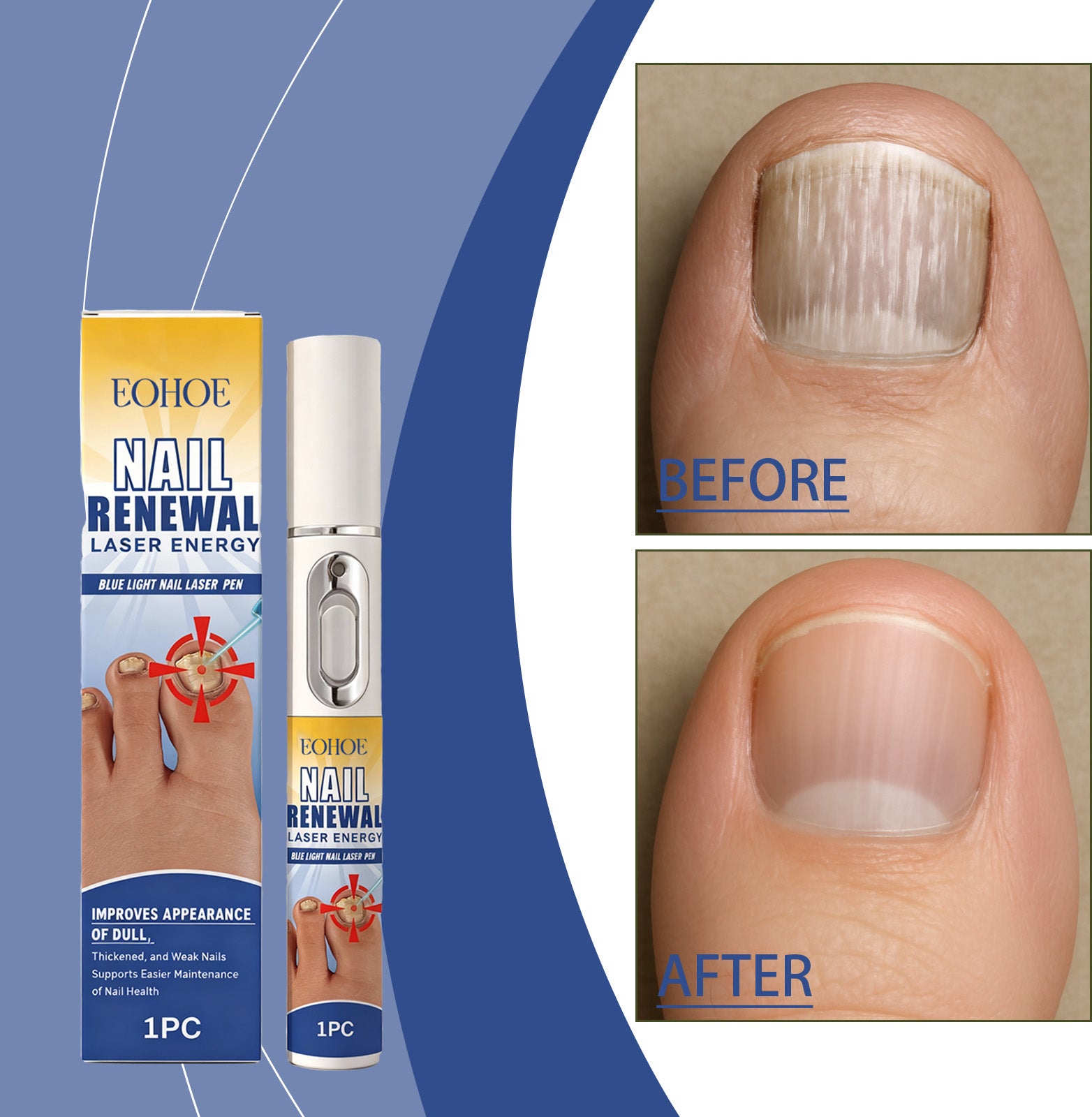 EELHOE Nail Care Pen Nourishes And Cares For Nails