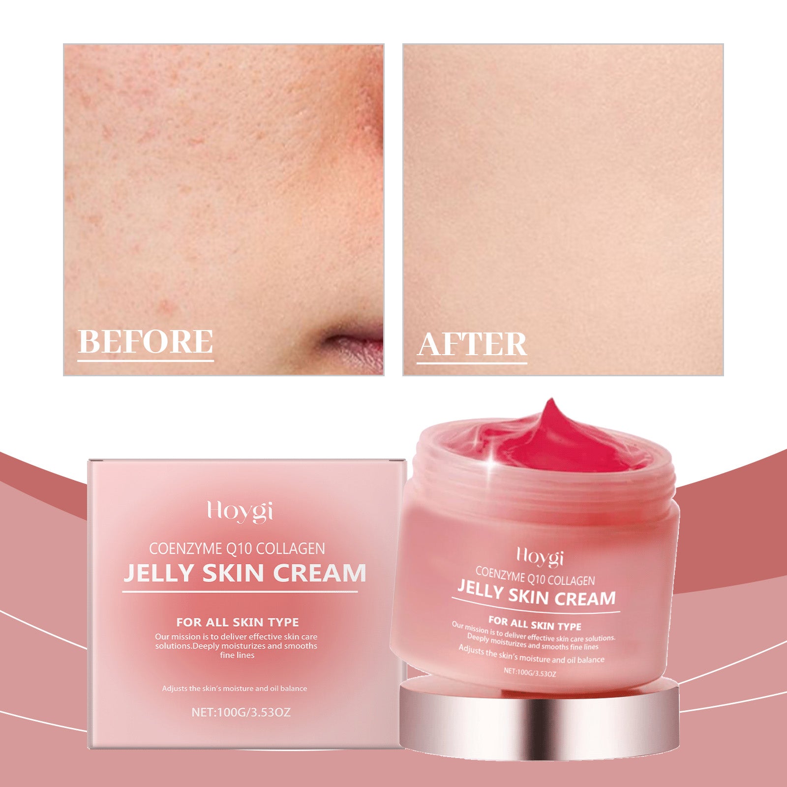 Hoygi Collagen Jelly Cream