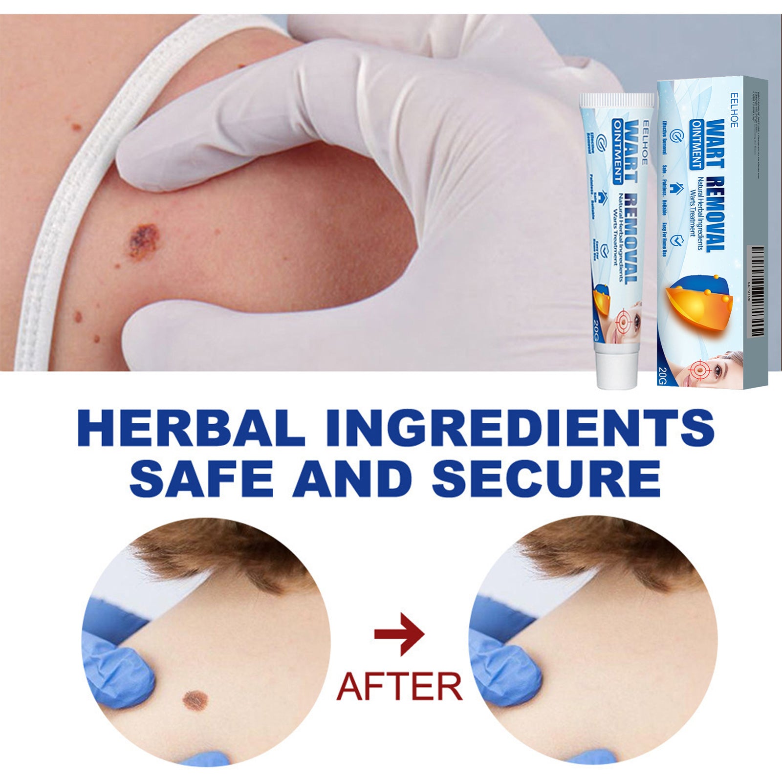 EELHOE Keyu Cream, Clean Skin Repair Care Body Face Remove Face Label Keyu