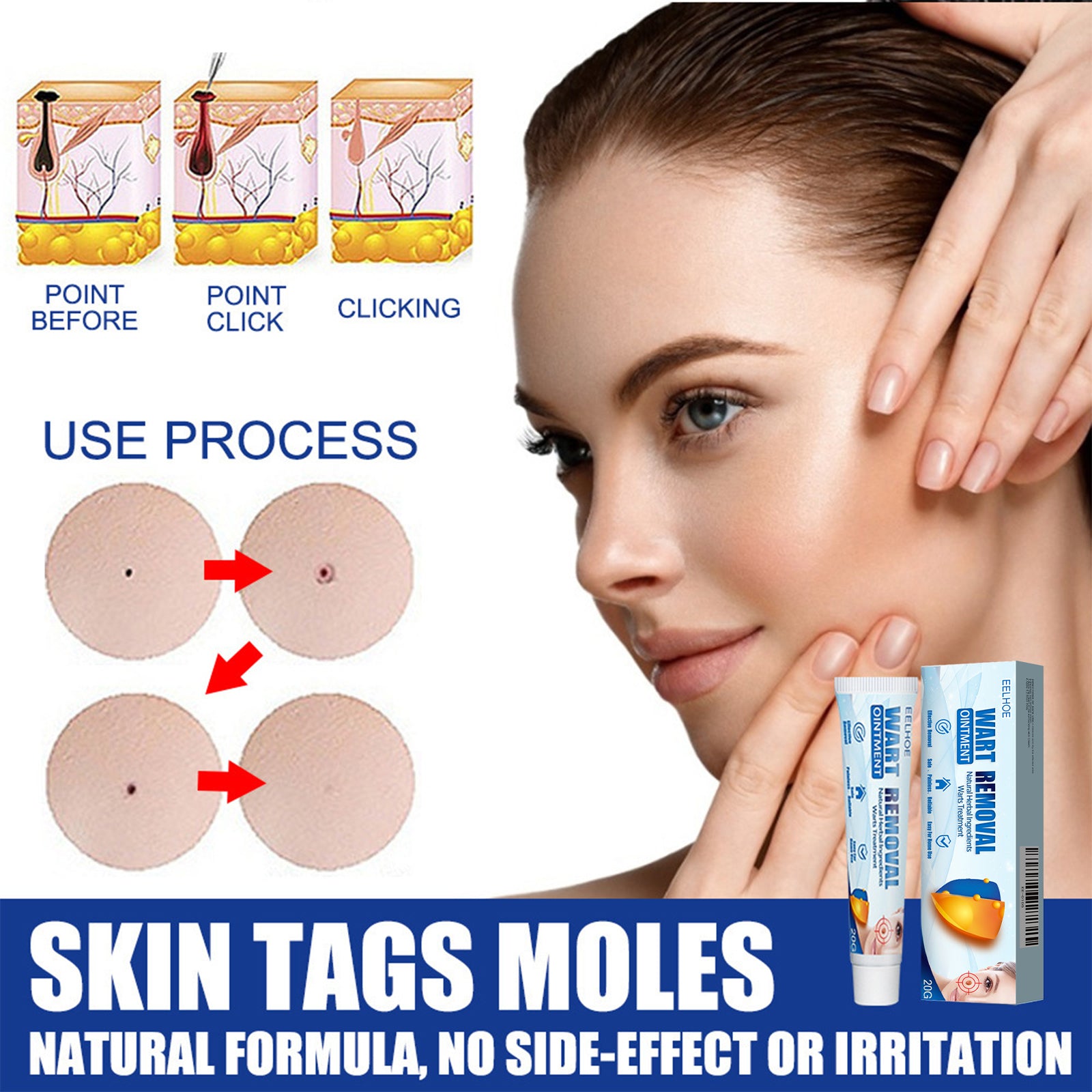 EELHOE Keyu Cream, Clean Skin Repair Care Body Face Remove Face Label Keyu