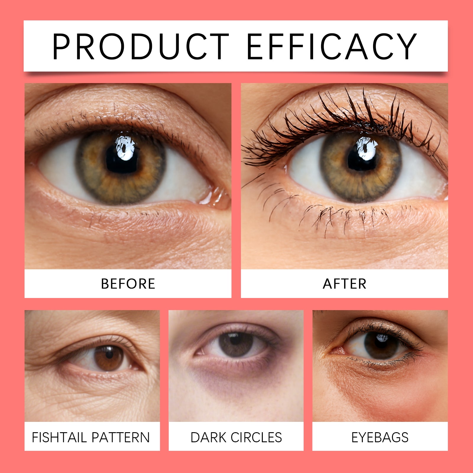 Hoygi Eye Moisturizing Gel Gently Nourishes The Skin Around The Eyes And