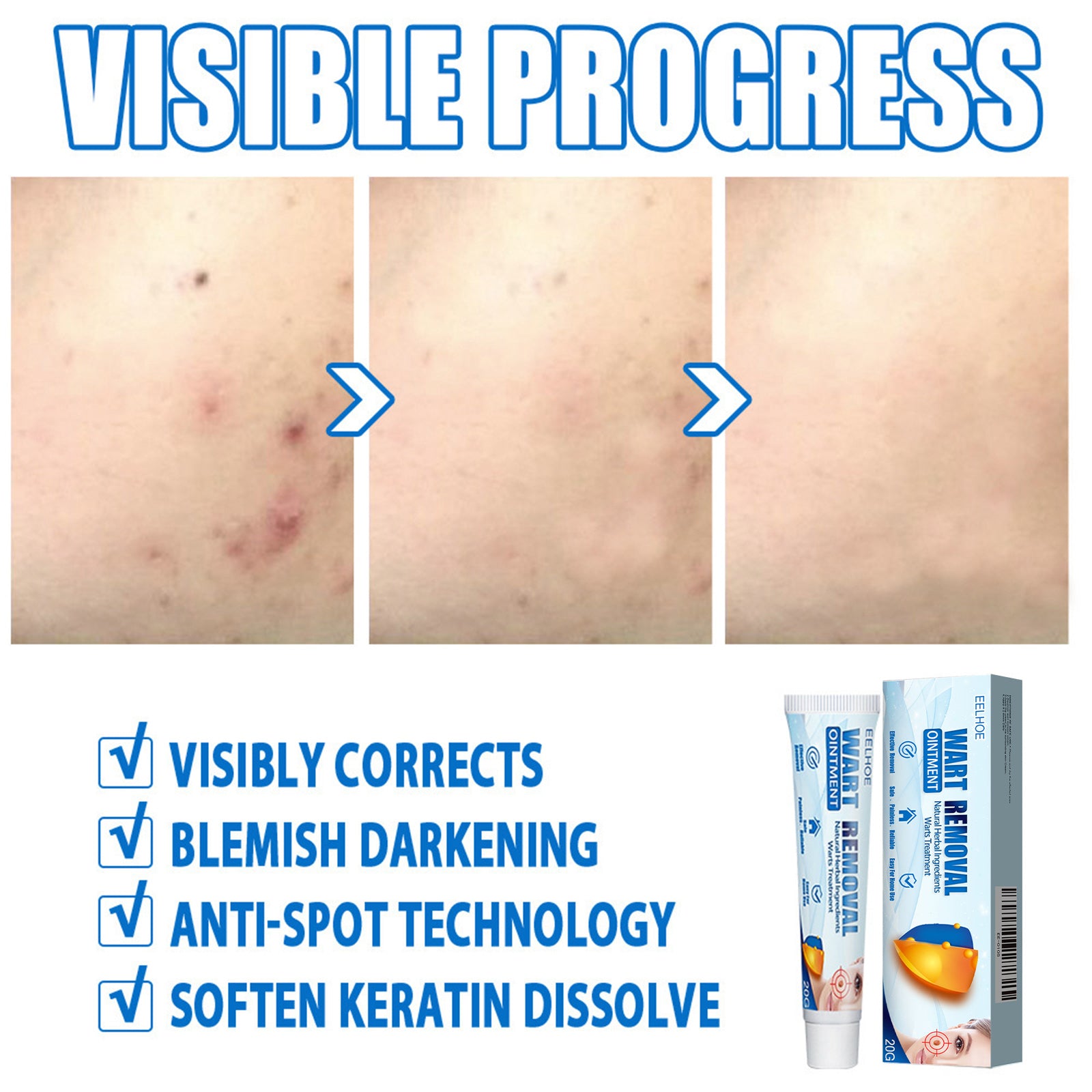 EELHOE Keyu Cream, Clean Skin Repair Care Body Face Remove Face Label Keyu