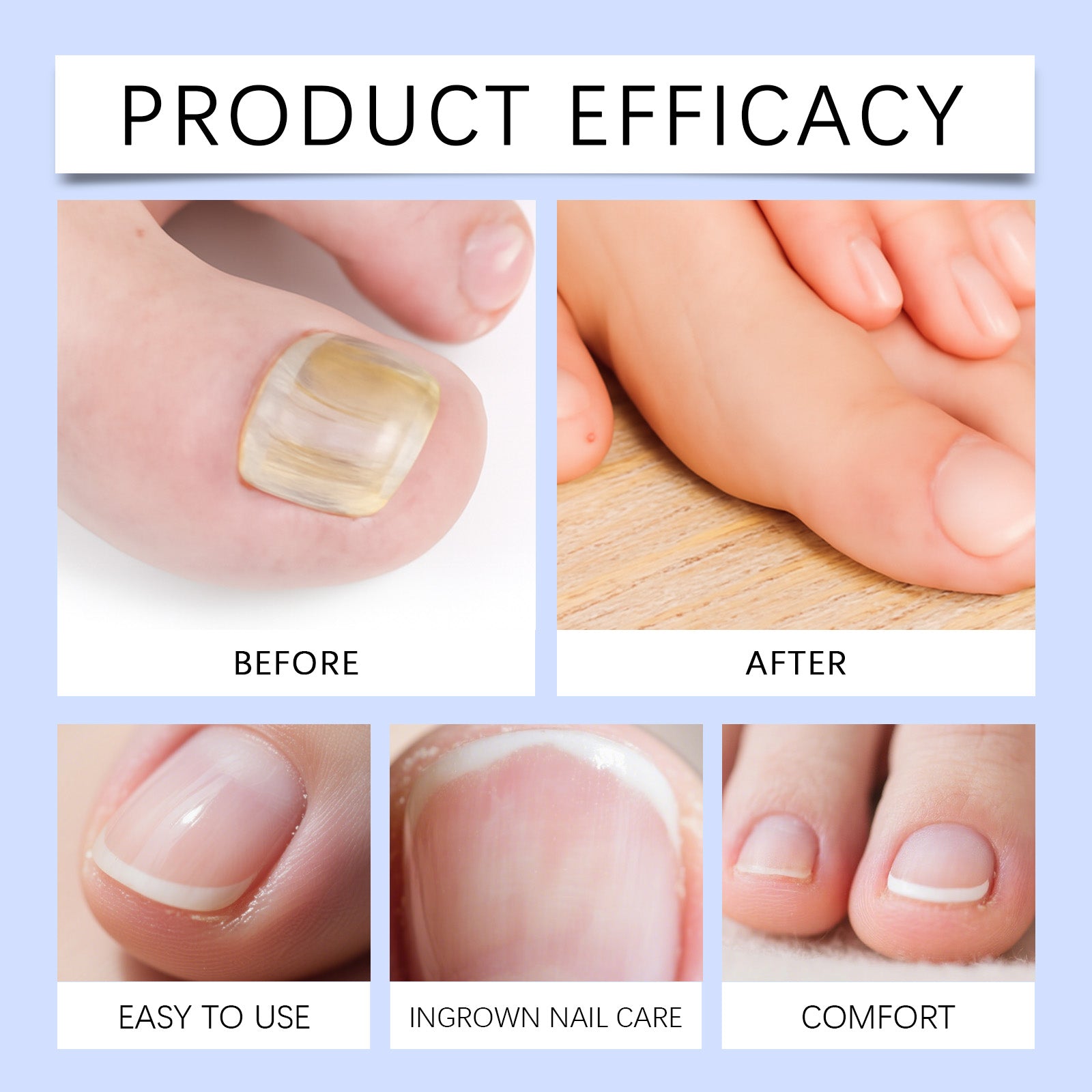 EELHOE Nail Care Pen Nourishes And Cares For Nails